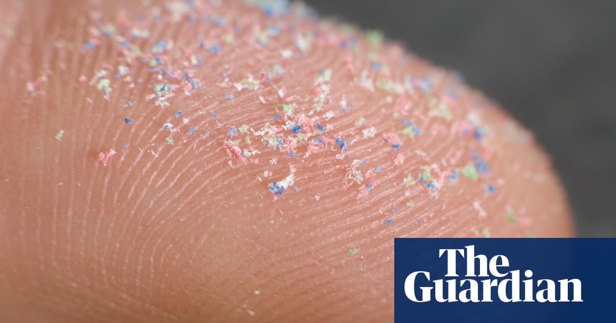 Levels of microplastics in human brains may be rapidly rising, study suggests - Today news